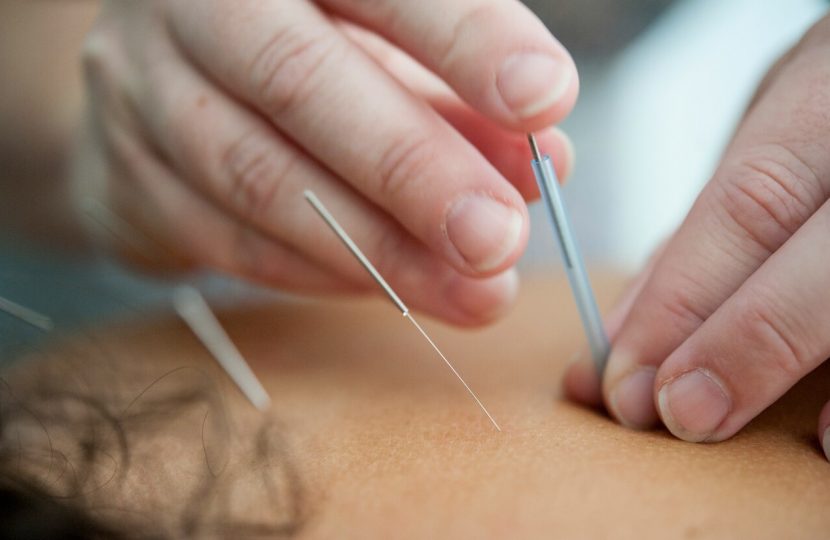 Traditional Chinese Medicine and Acupuncture Programs